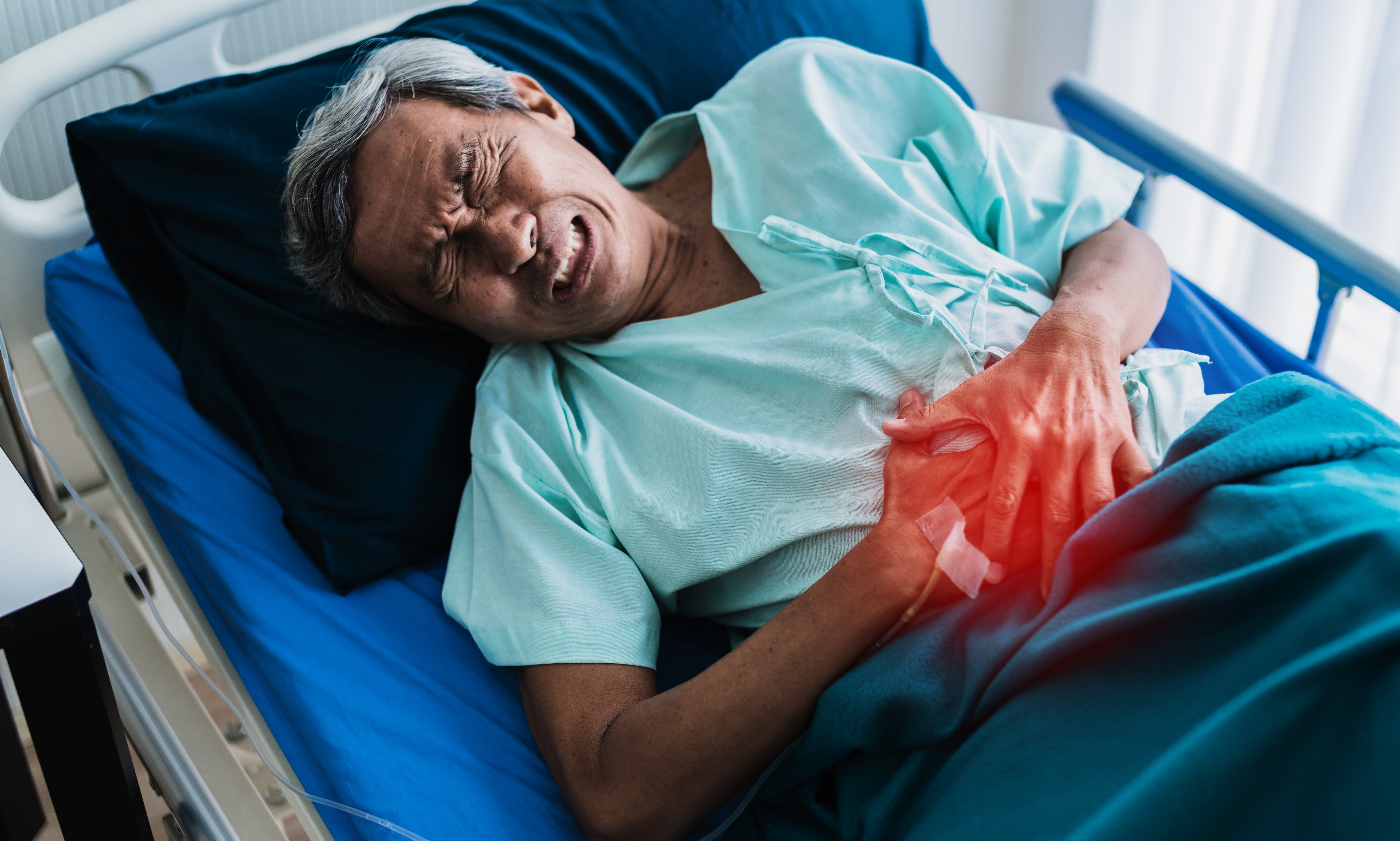 Kidney Stones: Causes, Symptoms, and Modern Treatment Options